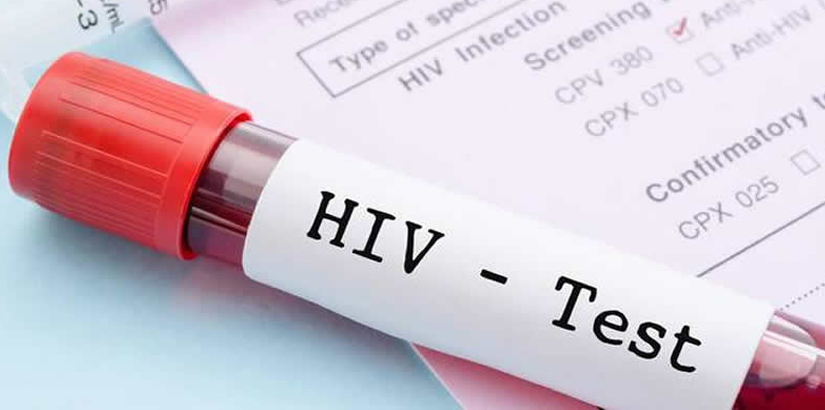 SALUD ESTUDIANTIL REFORZARÁ ACCIONES SOBRE PREVENCIÓN DEL VIH